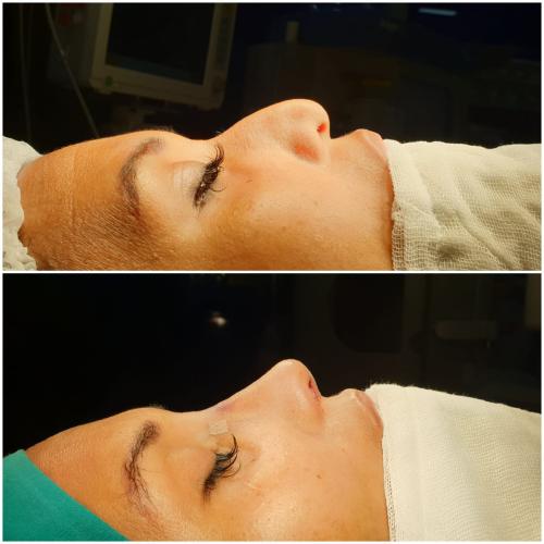 fotos antes y después de nuestros pacientes 3